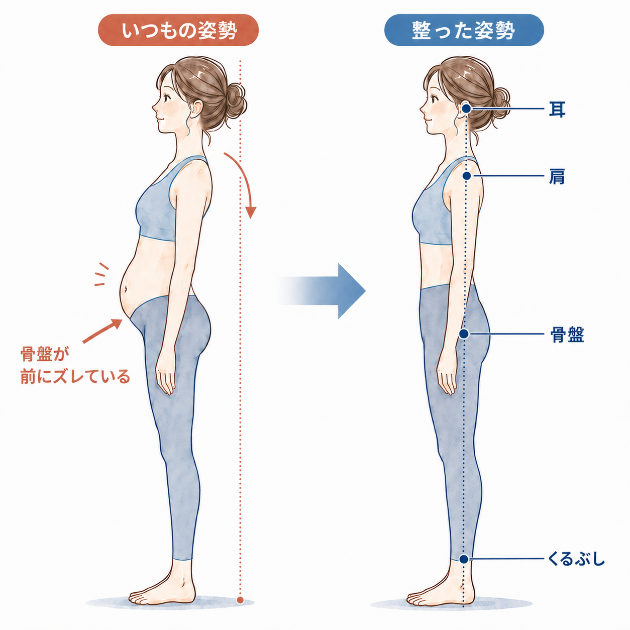 骨盤が前にズレている姿勢と整った姿勢の比較図