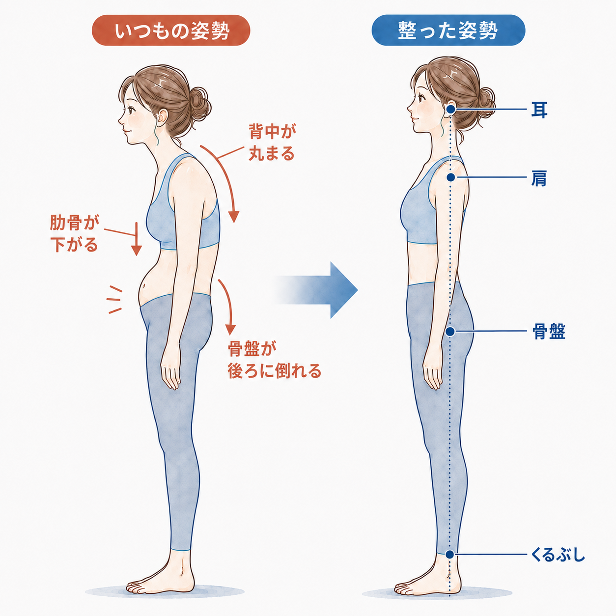 猫背で肋骨が下がり骨盤が後ろに倒れる姿勢と整った姿勢の比較図