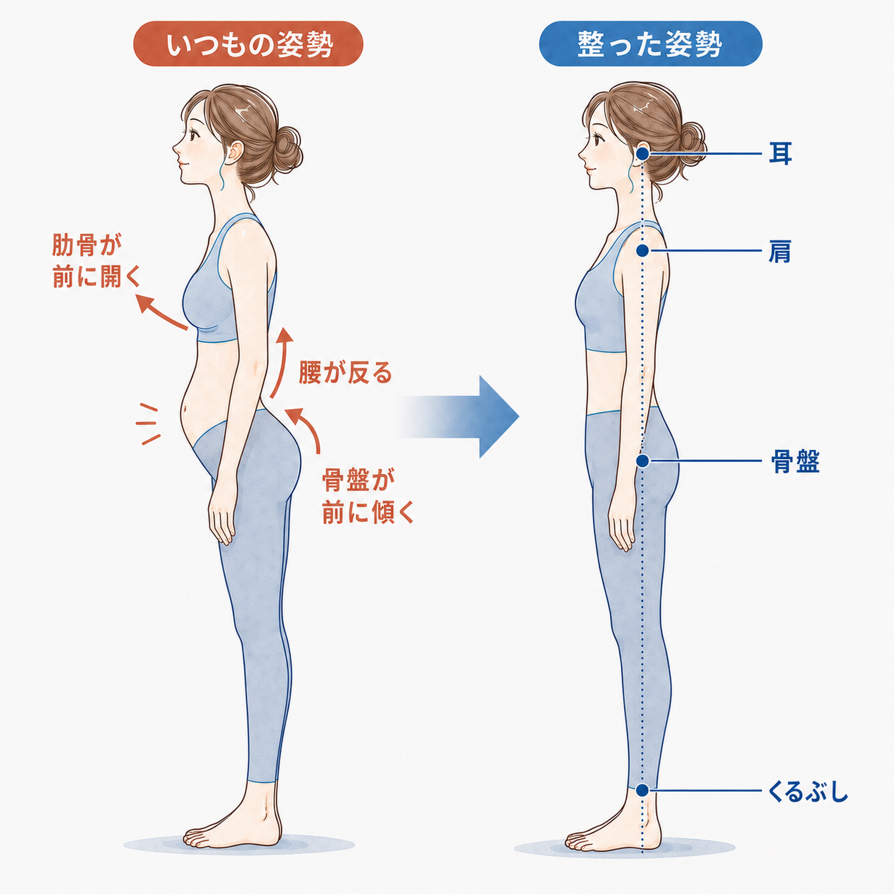 肋骨が前に開き骨盤が前に傾く姿勢と整った姿勢の比較図